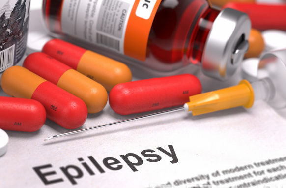 什么是假性药物难治性癫痫?